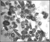 Nitrifiers-inside-cysts