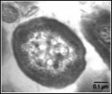 Cells-having-intracytoplasmic-membranes-and-carboxysomes-characteristic-to-the-autotrophic-nitrifiers